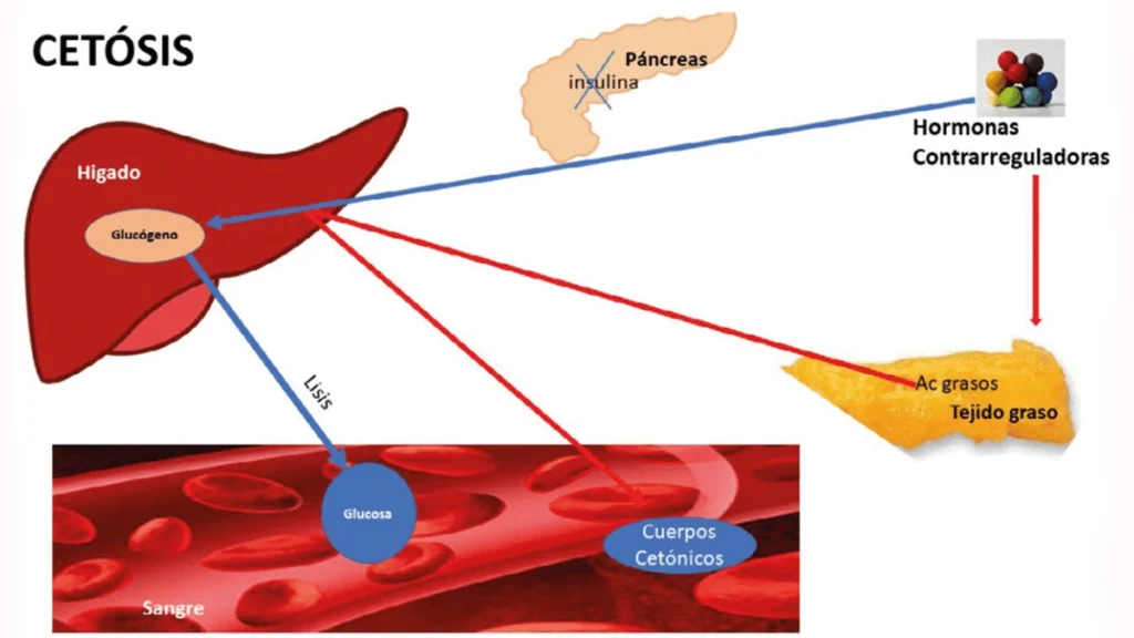 cetósis